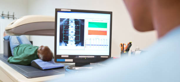 Bone Density Testing